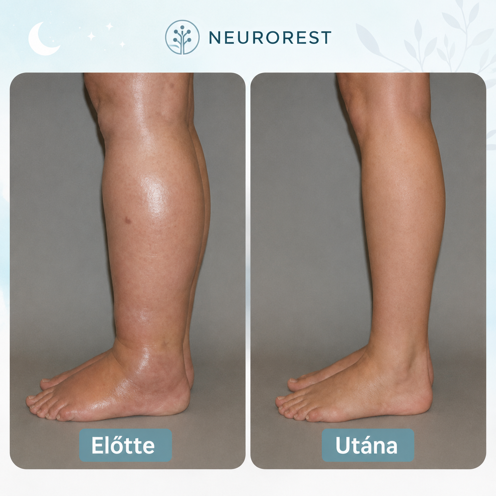 NeuroRest
